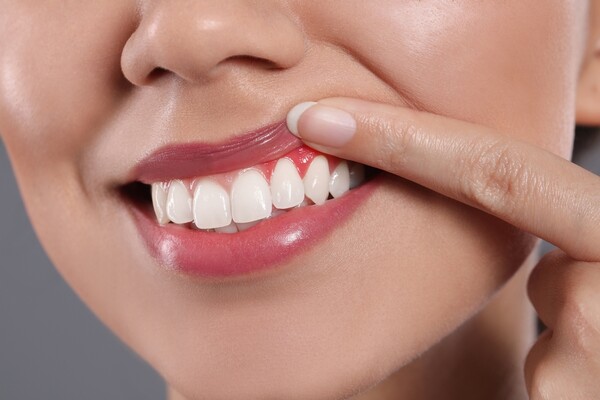 건강한 노년기를 맞으려면 평소 정기적인 구강 검진을 통해 치아를 건강하게 관리해야 한다.   /셔터스톡